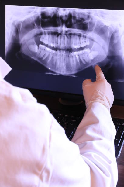 Best Root Canal Emergency Dentist  in Morn, GA